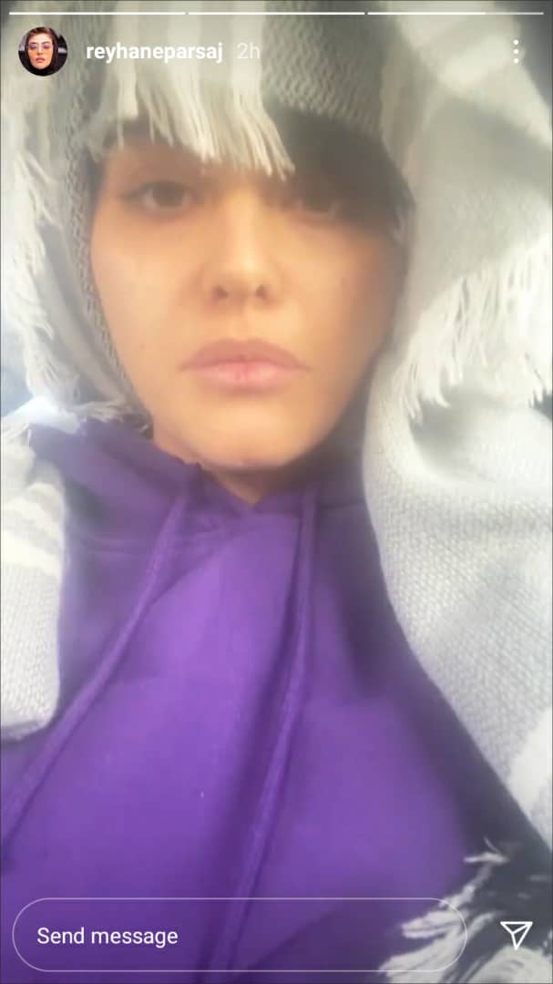 چهره داغون و بدون آرایش ریحانه پارسا در مهاجرت از ایران + عکس