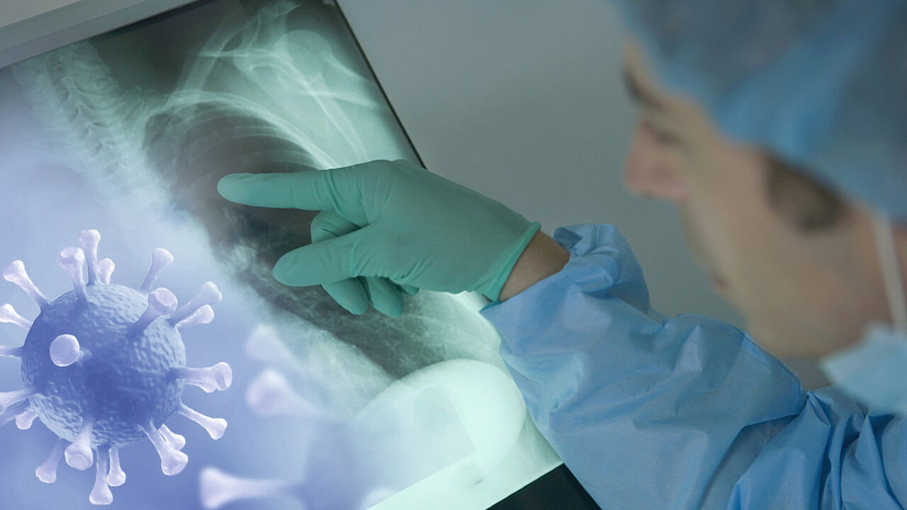 شمار مبتلایان به ویروس کرونا