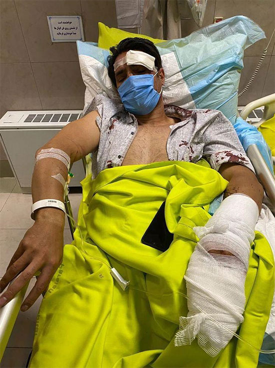 تصادف امیر حسین صادقی