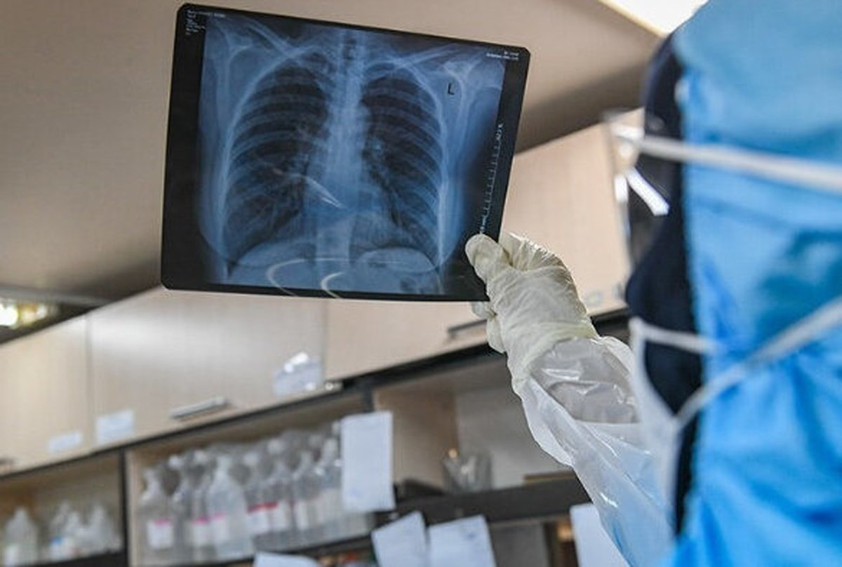 اخرین وضعیت ویروس کرونا در ایران