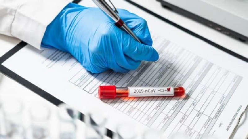 تست ویروس کرونا تست ویروس کرونا
