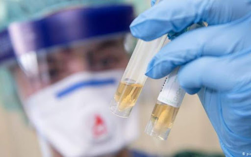 اعلام فهرست جدید آزمایشگاه&zwnj;های غیردولتی تشخیص کرونا