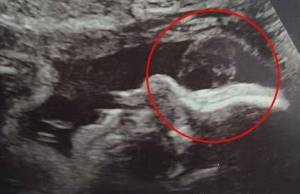 روح مادربزرگ در رحم زن جوان باردار روح مادربزرگ در رحم زن جوان باردار