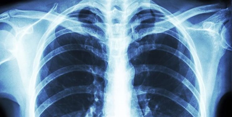 راه های پیشگیری از ویروس کرونا