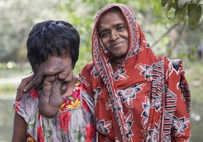 دختر بدون صورت