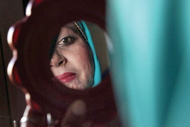 قربانیان اسید پاشی