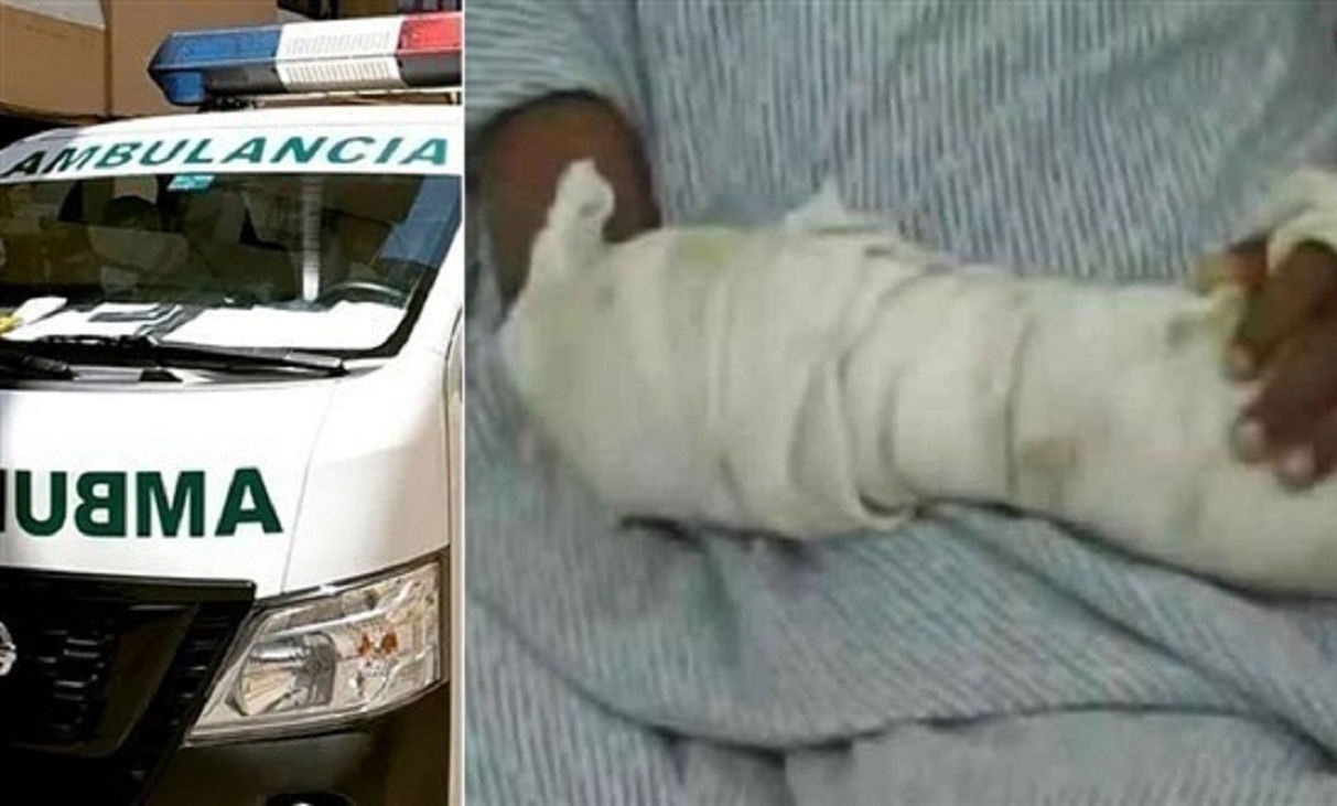 زنده زنده سوزاندن 