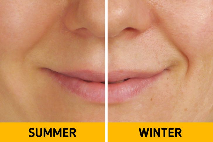 ۷ اتفاقی که در زمستان برای بدن رخ می دهد ۷ اتفاقی که در زمستان برای بدن رخ می دهد