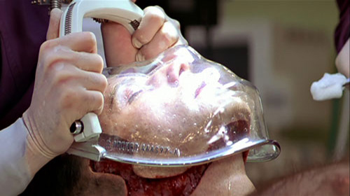 عمل پیوند صورت عمل پیوند صورت