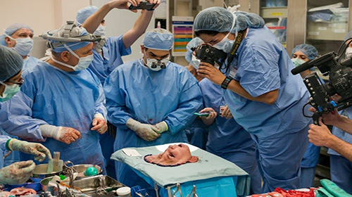 عمل پیوند صورت عمل پیوند صورت