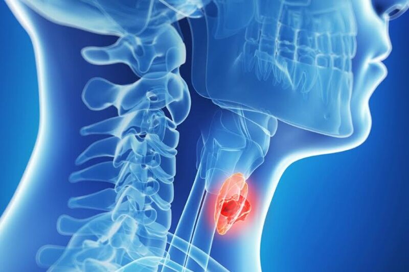 ۱۰ نشانه مخفی ابتلا به بیماری تیروئید!
