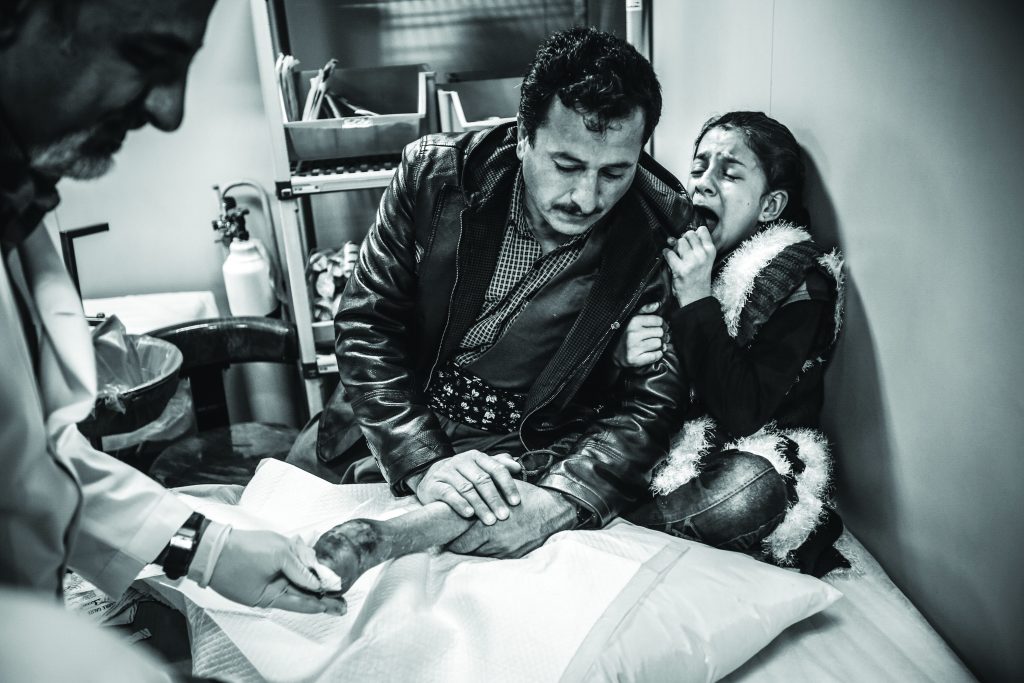 روایت یک قربانی مین از آسیبهای روانشناختی این معضل روایت یک قربانی مین از آسیبهای روانشناختی این معضل