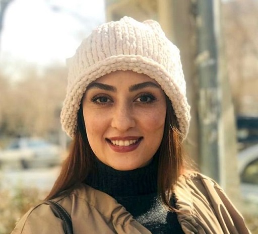 چهره پر کک و مک خانم بازیگر بدون آرایش + عکس