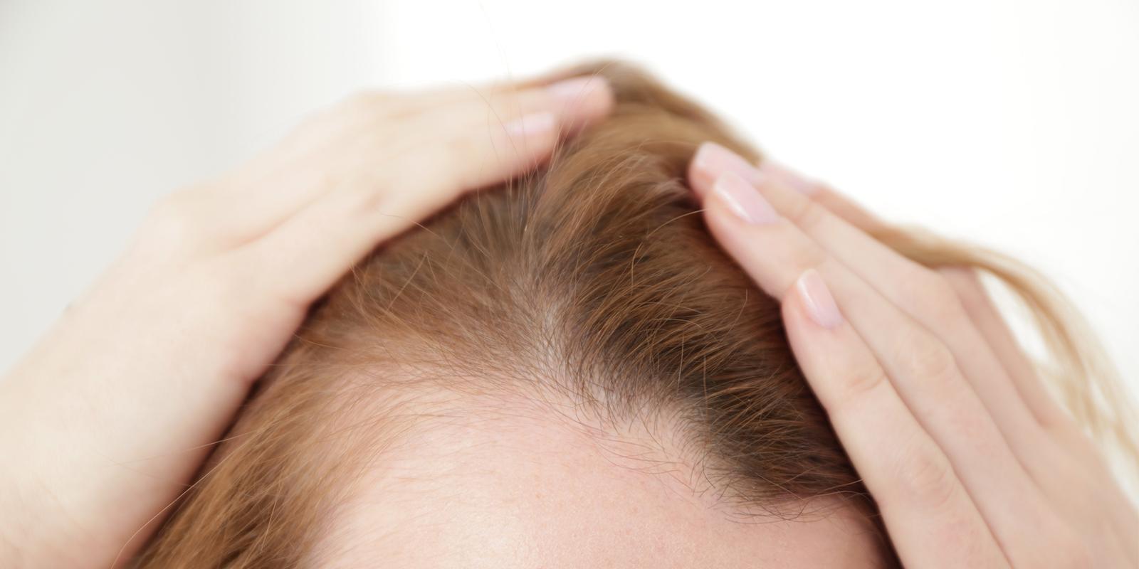 معجزه این ۹ خوراکی در پرپشت شدن موها