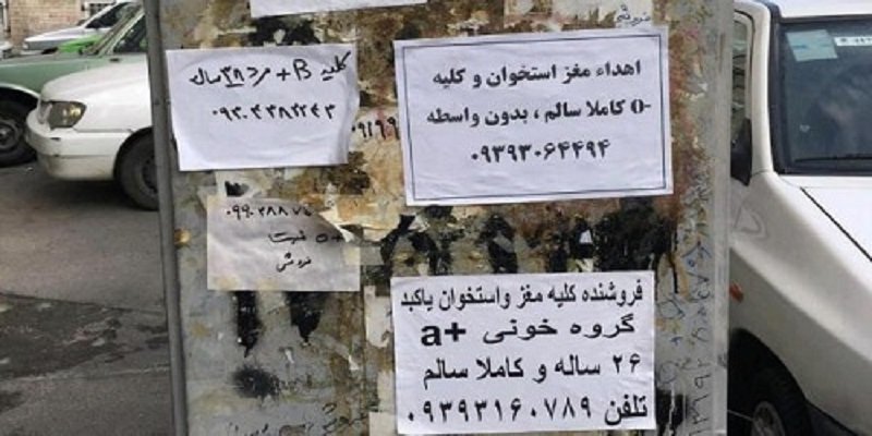 ۲۱۴۶ بیمار در صف پیوند کلیه/ هشدار درباره کلیه‌فروشی