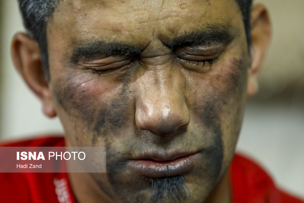 مصدومان چهارشنبه‌سوری سال ۱۴۰۰