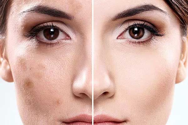 پوست و زیبایی