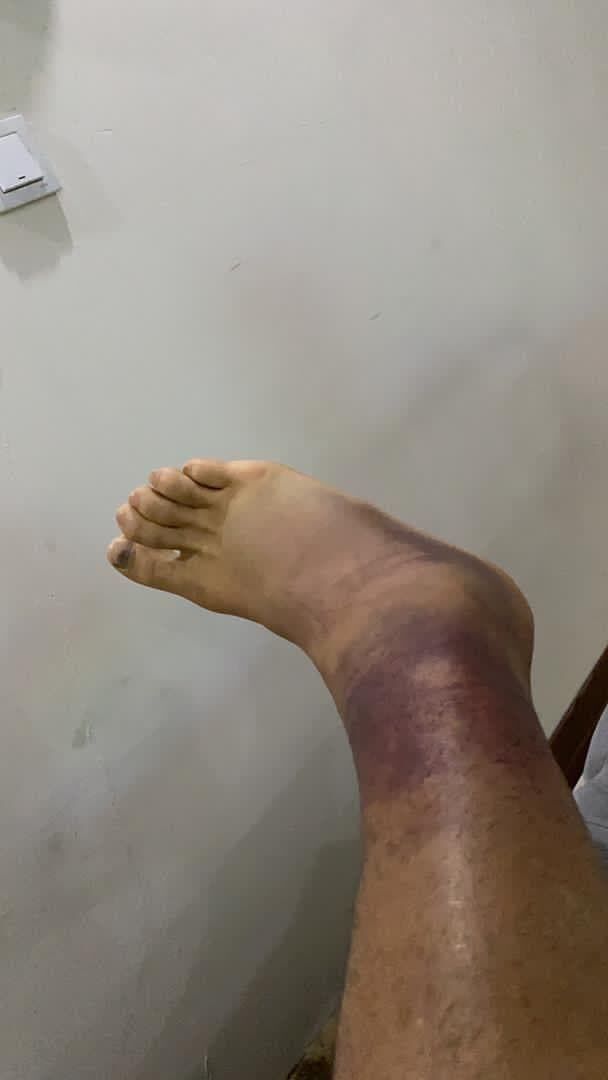 تلخ‌ترین تصاویر و خبر بد برای پرسپولیسی‌ها/ کنعانی زادگان در دربی غایب است؟