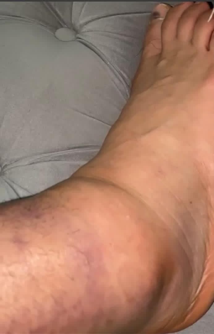 تلخ‌ترین تصاویر و خبر بد برای پرسپولیسی‌ها/ کنعانی زادگان در دربی غایب است؟