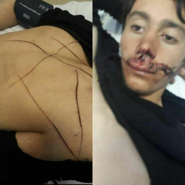 زیرپوست جنایت نظامیان ترکیه علیه کردهای ایرانی/ واکنش مقامات رسمی به جنایت نیروهای مرزی علیه دو کولبر ایرانی چه بود؟ / نماینده مهاباد در مجلس: بعد جنایت نیروهای نظامی ترکیه حتی کاردار این کشور احضار نشد! زیرپوست جنایت نظامیان ترکیه علیه کردهای ایرانی/ واکنش مقامات رسمی به جنایت نیروهای مرزی علیه دو کولبر ایرانی چه بود؟ / نماینده مهاباد در مجلس: بعد جنایت نیروهای نظامی ترکیه حتی کاردار این کشور احضار نشد!