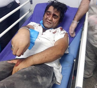 حمله خونین به 2 بازیگر