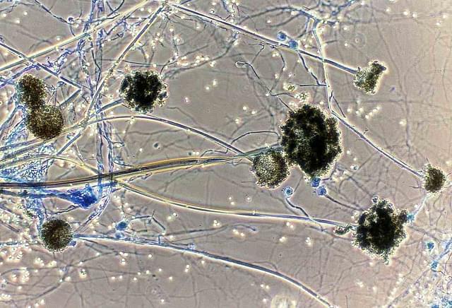 قارچ سیاه چیست؟