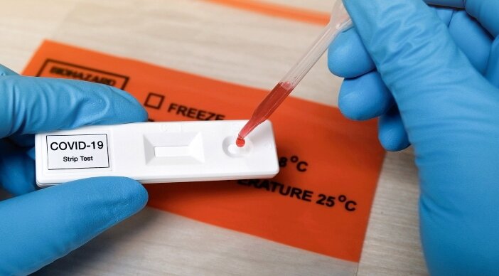 راه های تشخیص ویروس کرونا راه های تشخیص ویروس کرونا