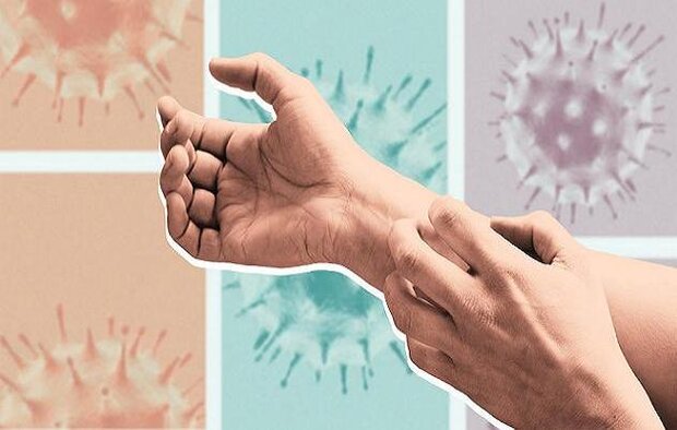 علائم جدید ابتلا ویروس کرونا