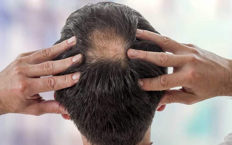 عوارض جدید ابتلا به کرونا عوارض جدید ابتلا به کرونا