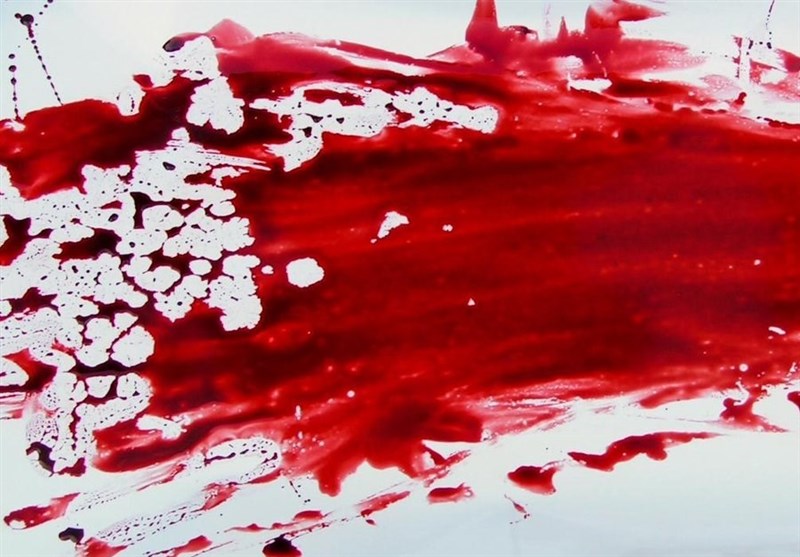 نابینا شدن چشم پسر تهرانی در دعوایی خونین + جزییات نابینا شدن چشم پسر تهرانی در دعوایی خونین + جزییات