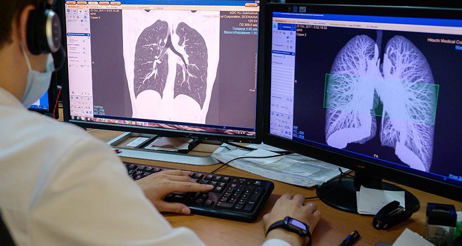 زمان انجام سی تی اسکن بیماران کرونایی