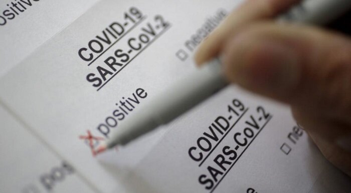 جعل آزمایش کرونا و استفاده از آن چه مجازاتی دارد؟