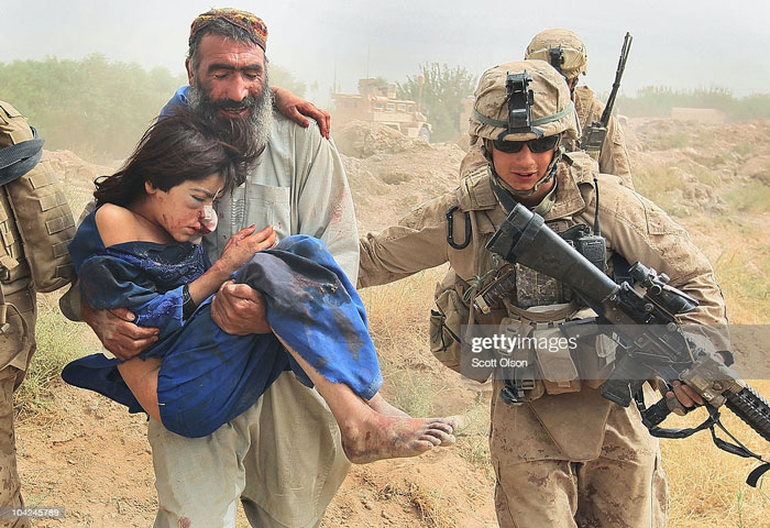 کودکان زخمی و معلول در جنگ افغانستان کودکان زخمی و معلول در جنگ افغانستان