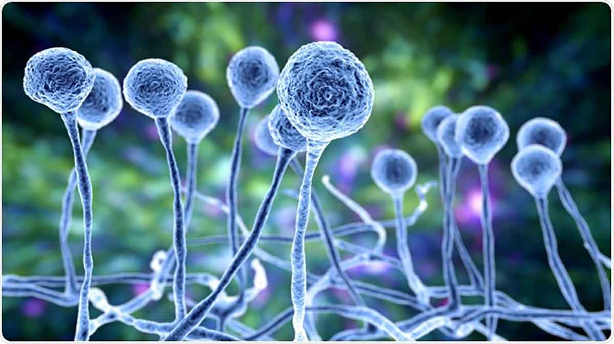 علائم ابتلا به قارچ سیاه