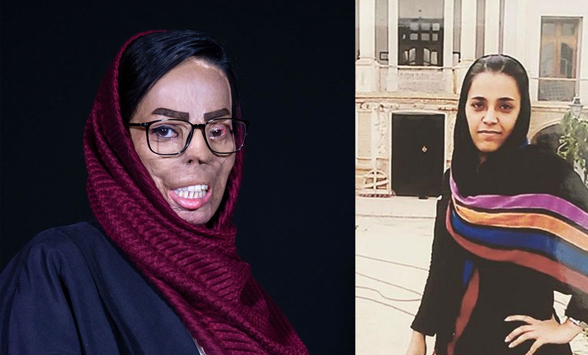 قربانیان اسیدپاشی