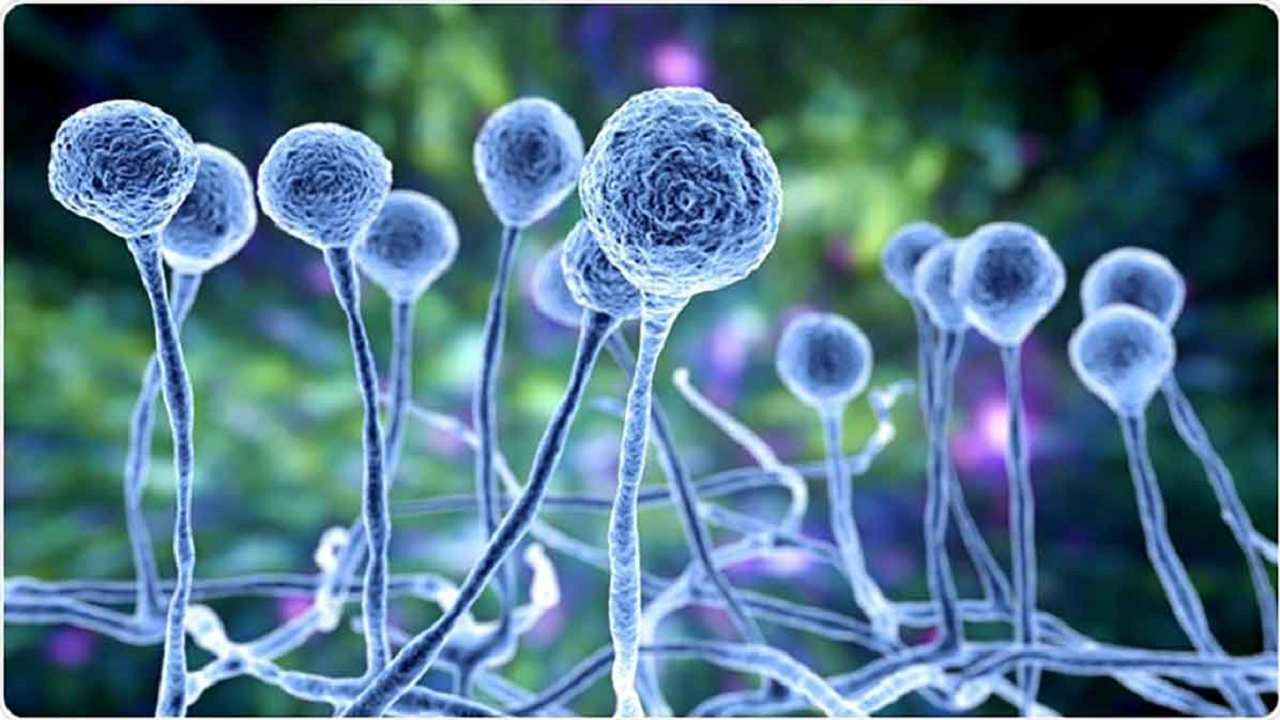 شیوع قارچ سیاه در بیماران دیابتی