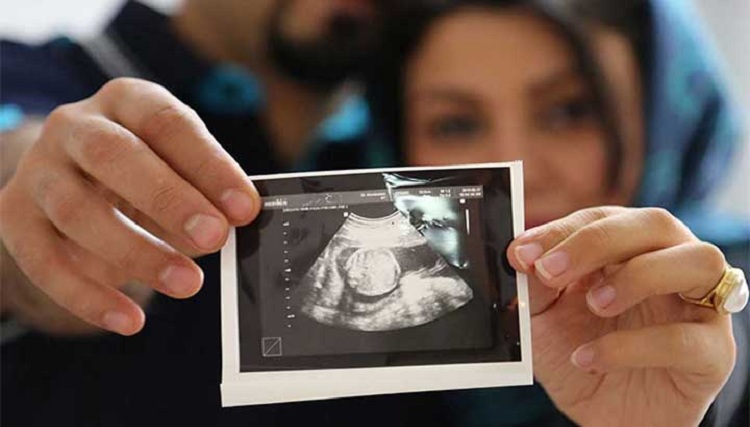 طرح جوانی جمعیت طرح جوانی جمعیت