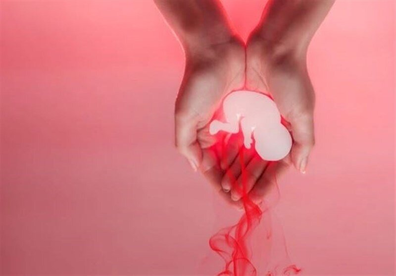 سقط جنین غیرقانونی سقط جنین غیرقانونی