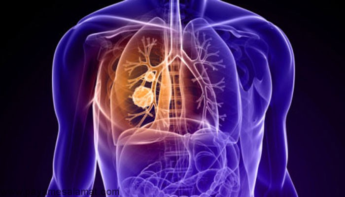 شمار مبتلایان به ویروس کرونا شمار مبتلایان به ویروس کرونا