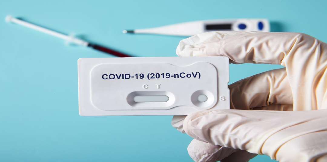 تست ویروس کرونا تست ویروس کرونا