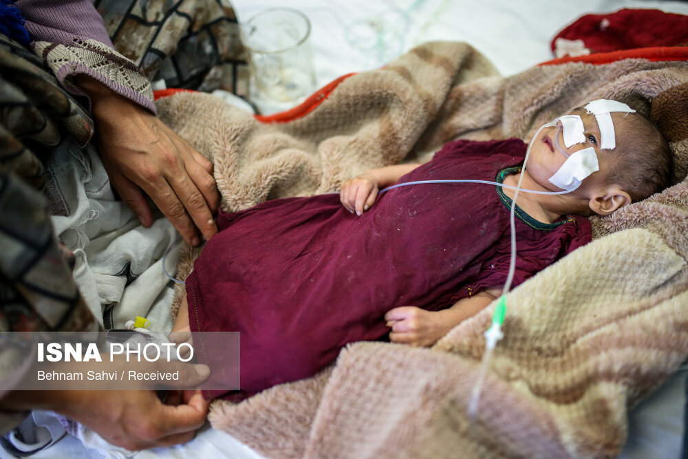 بحران سوء تغذیه کودکان در افغانستان/تصاویر