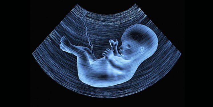 حذف غربالگری جنین