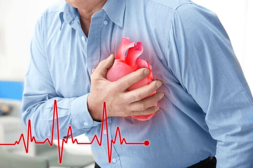 نرم افزاری که احتمال حمله قلبی را اطلاع می‌دهد