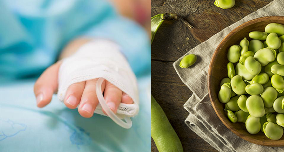 بیماری فاویسم یا باقلایی چیست؟ + علائم