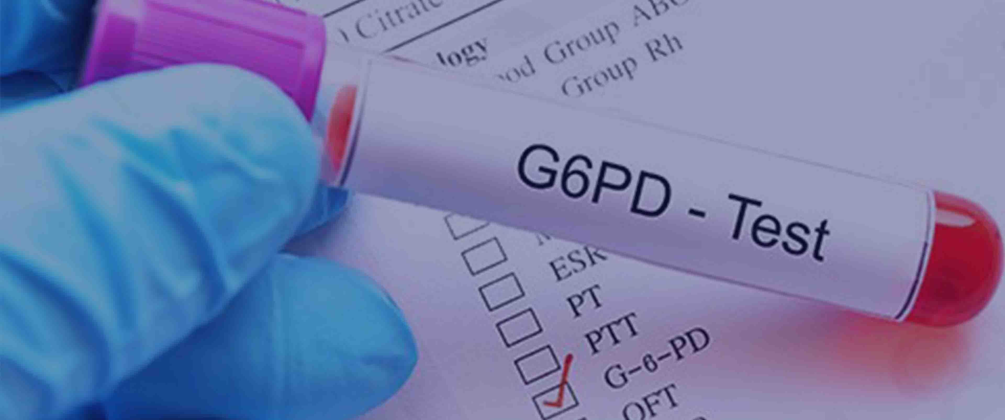 بیماری فاویسم یا باقلایی چیست؟ + علائم