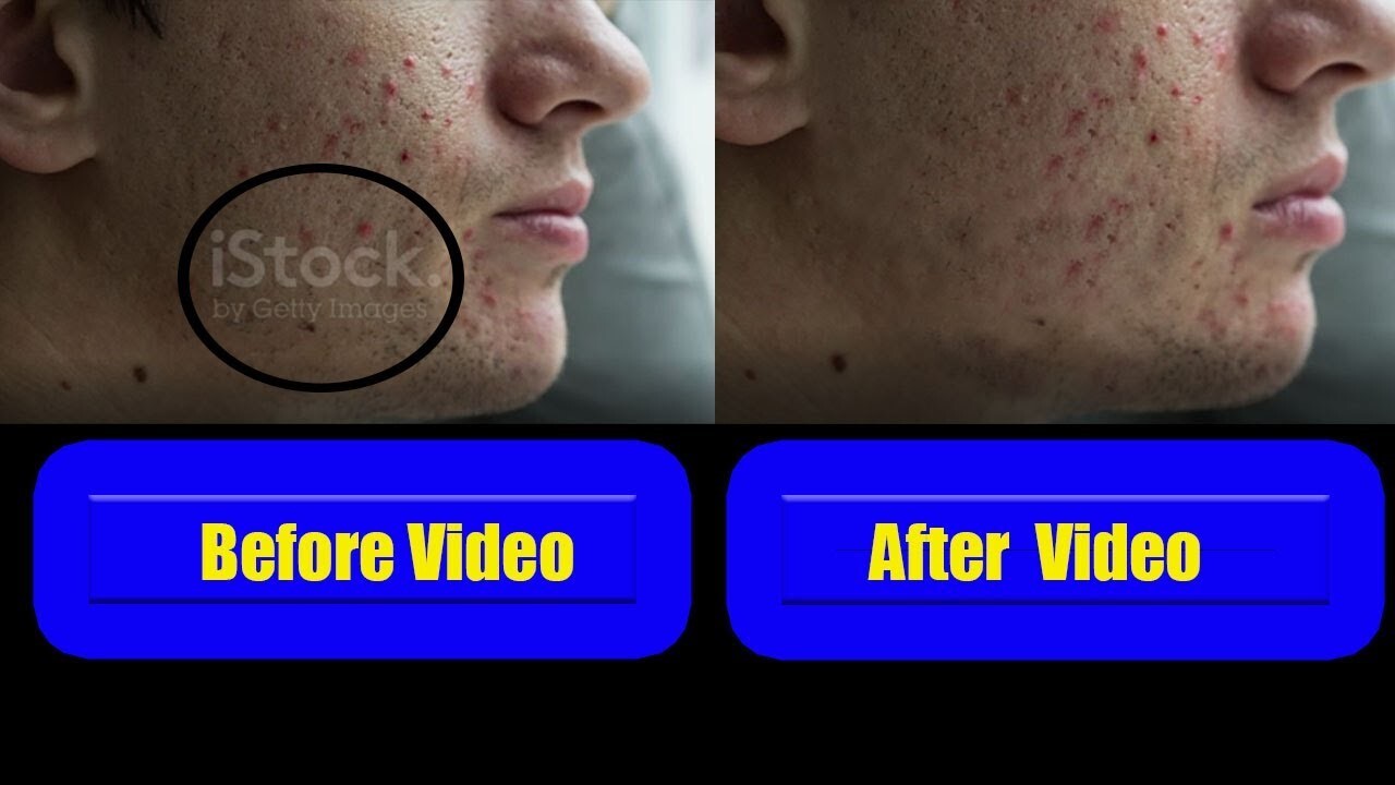 معرفی برنامه پاک کردن نوشته از روی فیلم