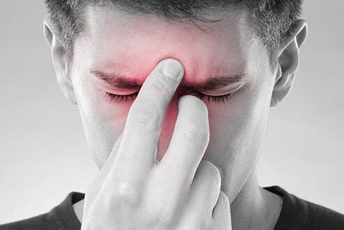 تشخیص سینوزیت از سرماخوردگی