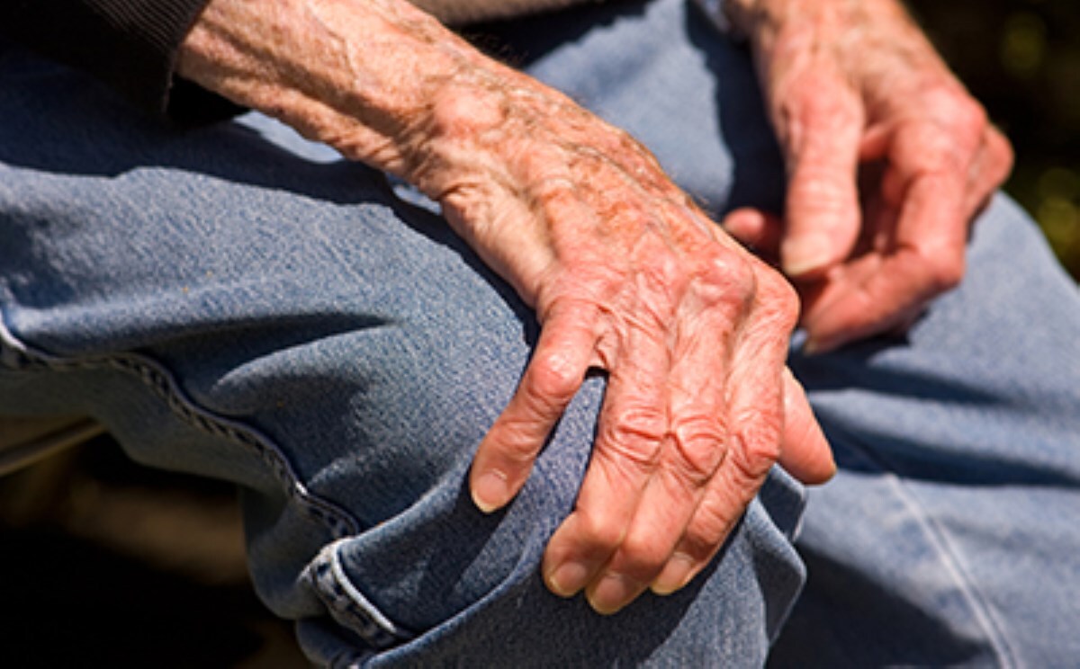 بیماری آرتروز چیست؟