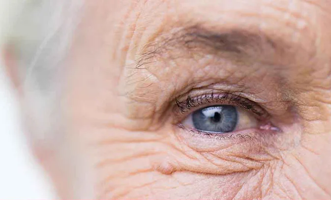 علل سنگینی پلک و خواب آلودگی