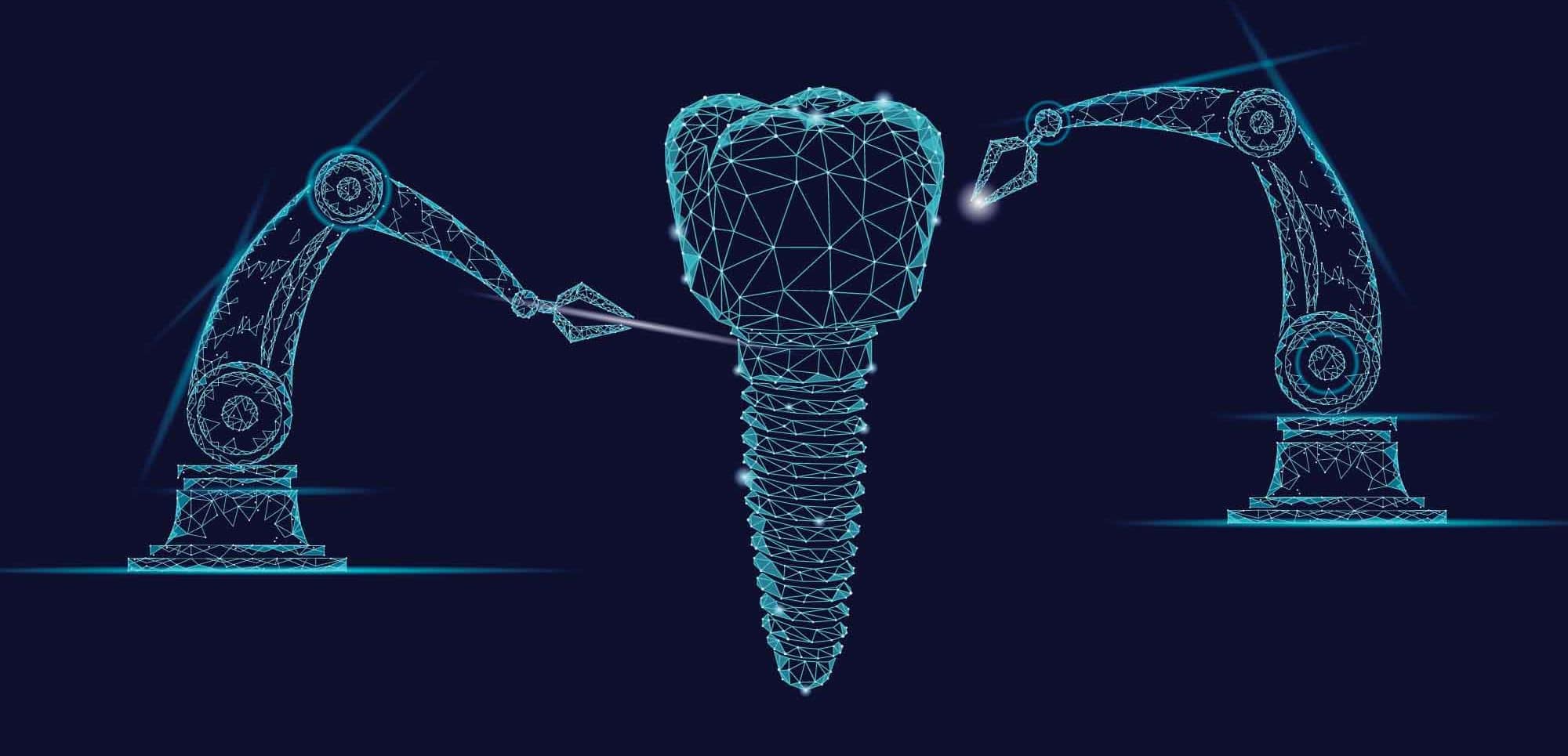 ایمپلنت فوری دیجیتال